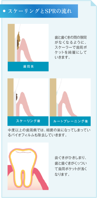 スケーリングとSPRの流れ
